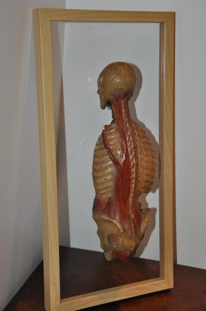 écorché Anatomique Du XIXème Siècle  : Dos écorché-photo-2