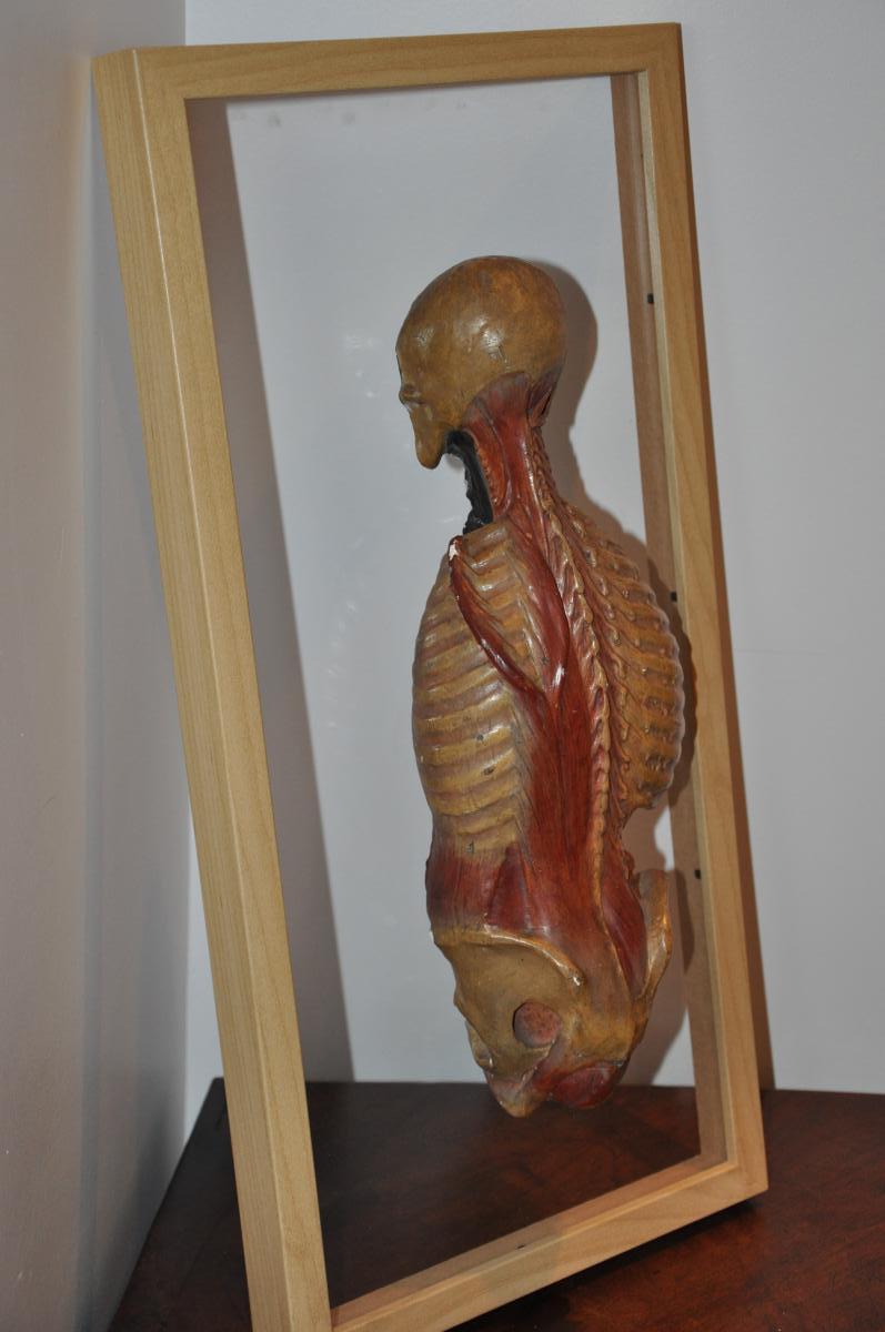 écorché Anatomique Du XIXème Siècle  : Dos écorché-photo-3