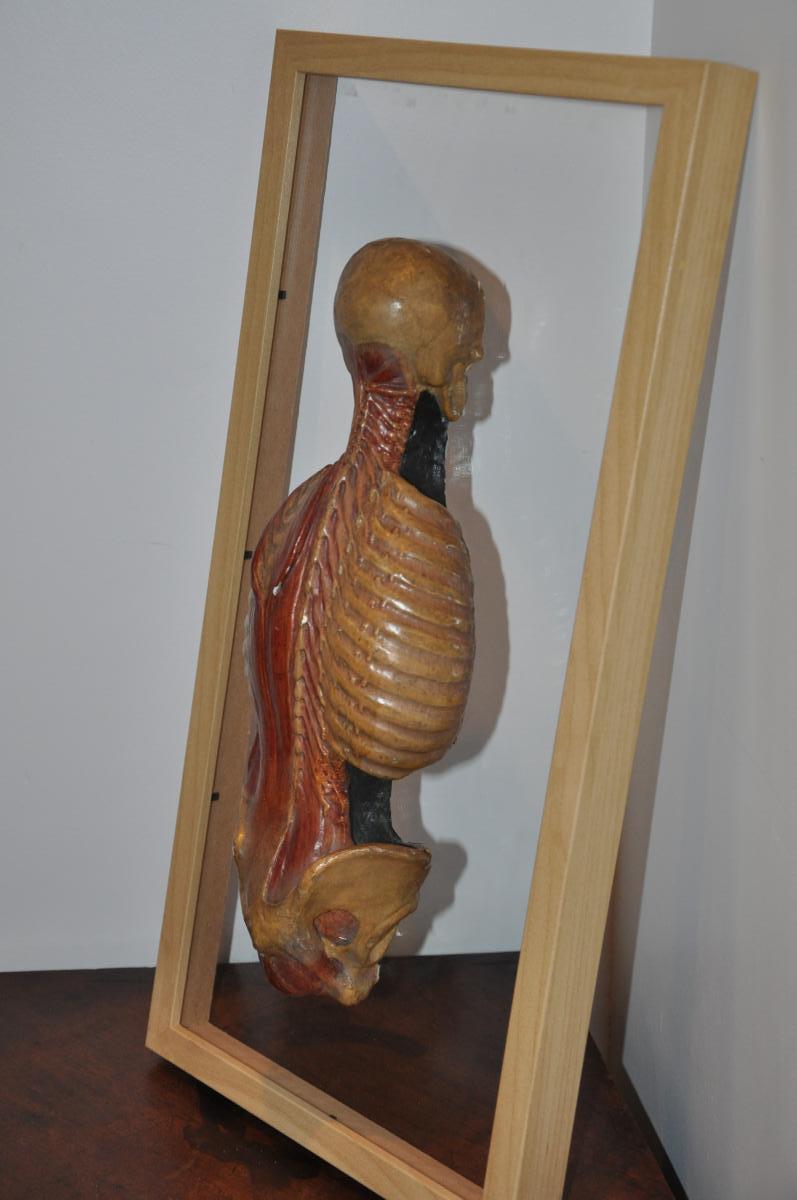 écorché Anatomique Du XIXème Siècle  : Dos écorché-photo-4
