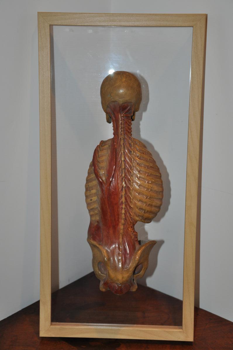 écorché Anatomique Du XIXème Siècle  : Dos écorché-photo-1