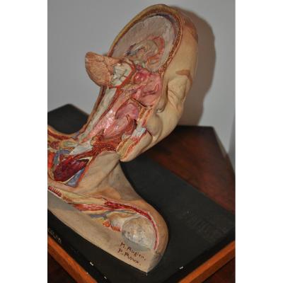 Half-head In Cross Section From XIXth Century: Study Of