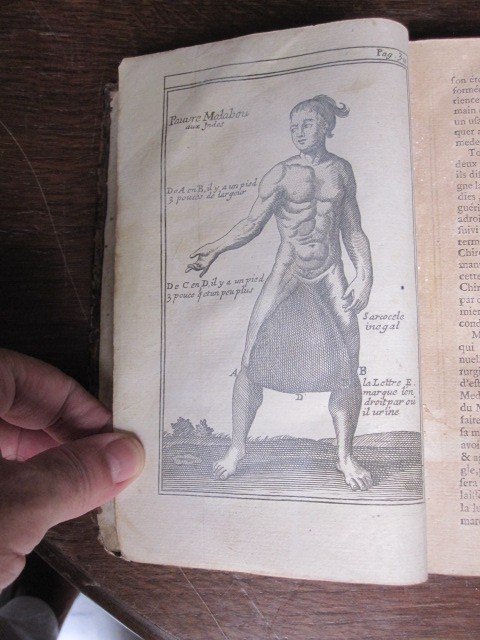 Livre De Chirurgie Au Jardin Royal. Paris1751. Bien Illustré Et Avec Reliure Originale-photo-4