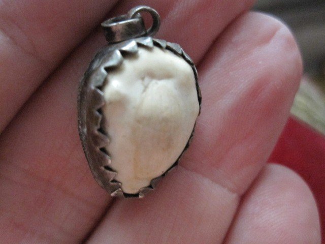 Amulets: Bezoar Stone And Crustacean Tongs? Spain Or Hispanic America XVIth Century-photo-3