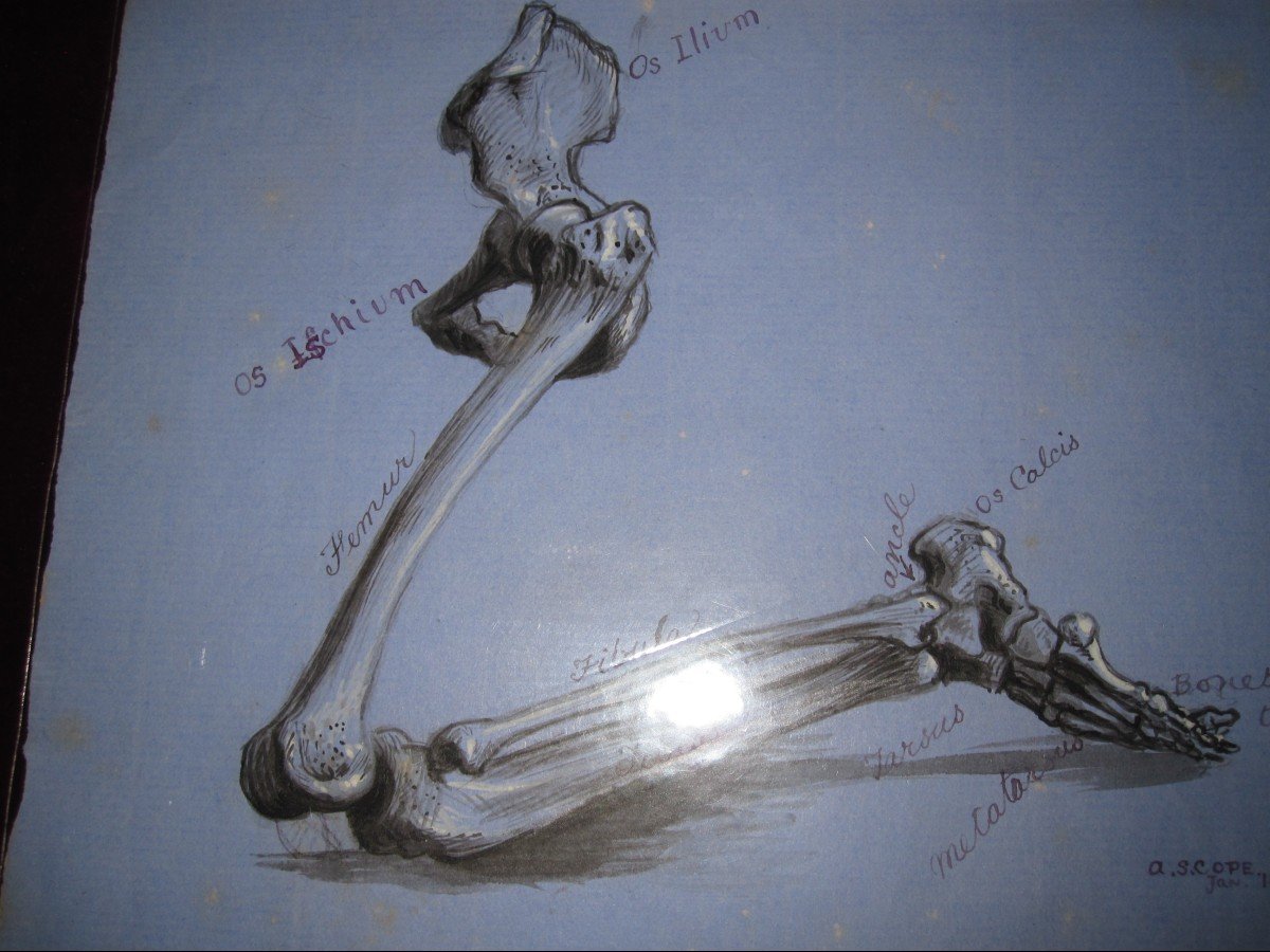 Anatomical Drawing In Ink And Wash. Leg Bones. Signed Asc 1871-photo-2
