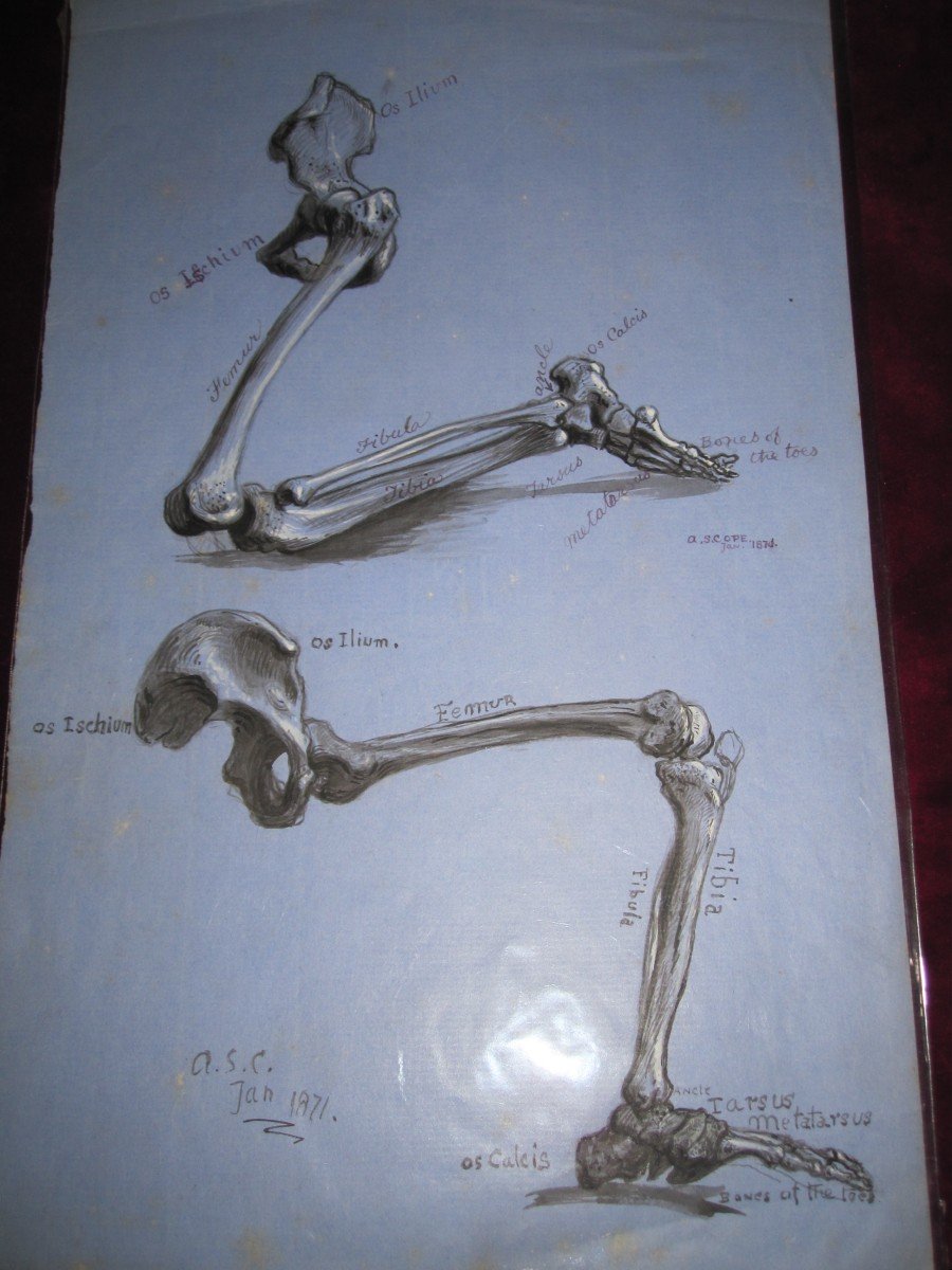 Anatomical Drawing In Ink And Wash. Leg Bones. Signed Asc 1871-photo-5