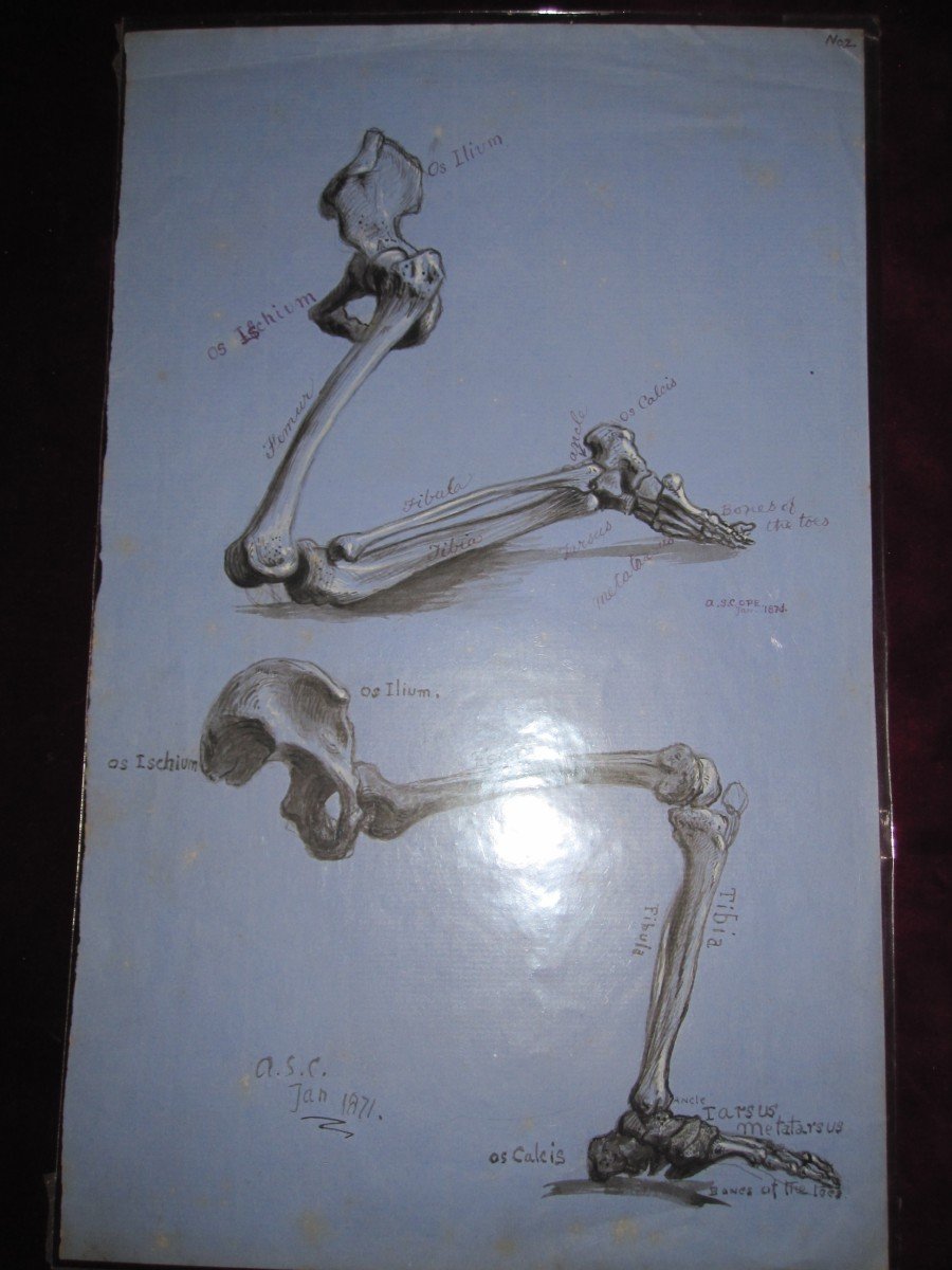 Anatomical Drawing In Ink And Wash. Leg Bones. Signed Asc 1871