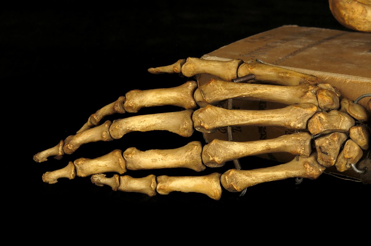 Old Anatomical Skeleton Arm, Late 19th Century Preparation / Oddities-photo-3