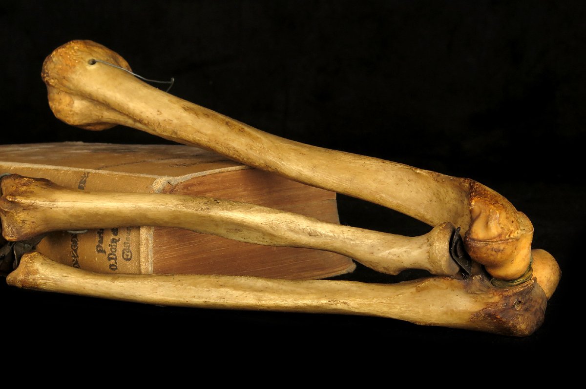 Old Anatomical Skeleton Arm, Late 19th Century Preparation / Oddities-photo-4