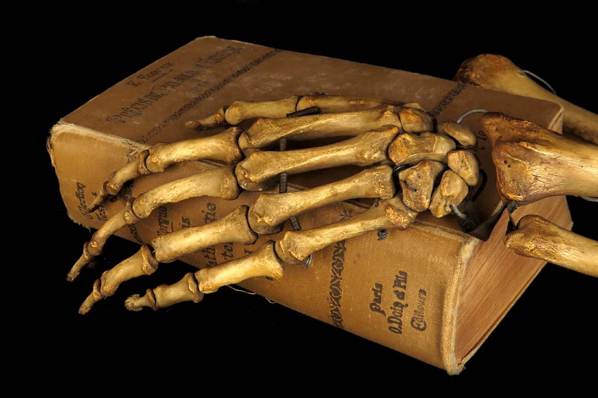 Old Anatomical Skeleton Arm, Late 19th Century Preparation / Oddities-photo-1