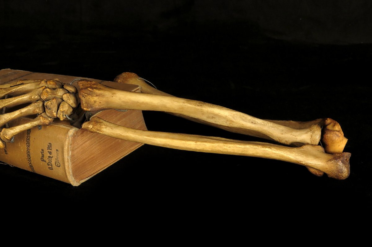 Old Anatomical Skeleton Arm, Late 19th Century Preparation / Oddities-photo-2