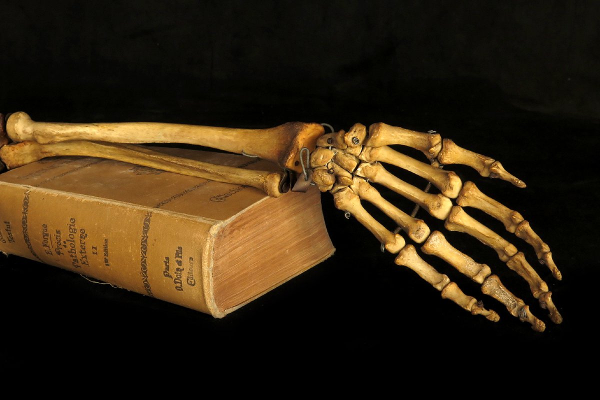 Old Anatomical Skeleton Arm, Late 19th Century Preparation / Oddities-photo-3