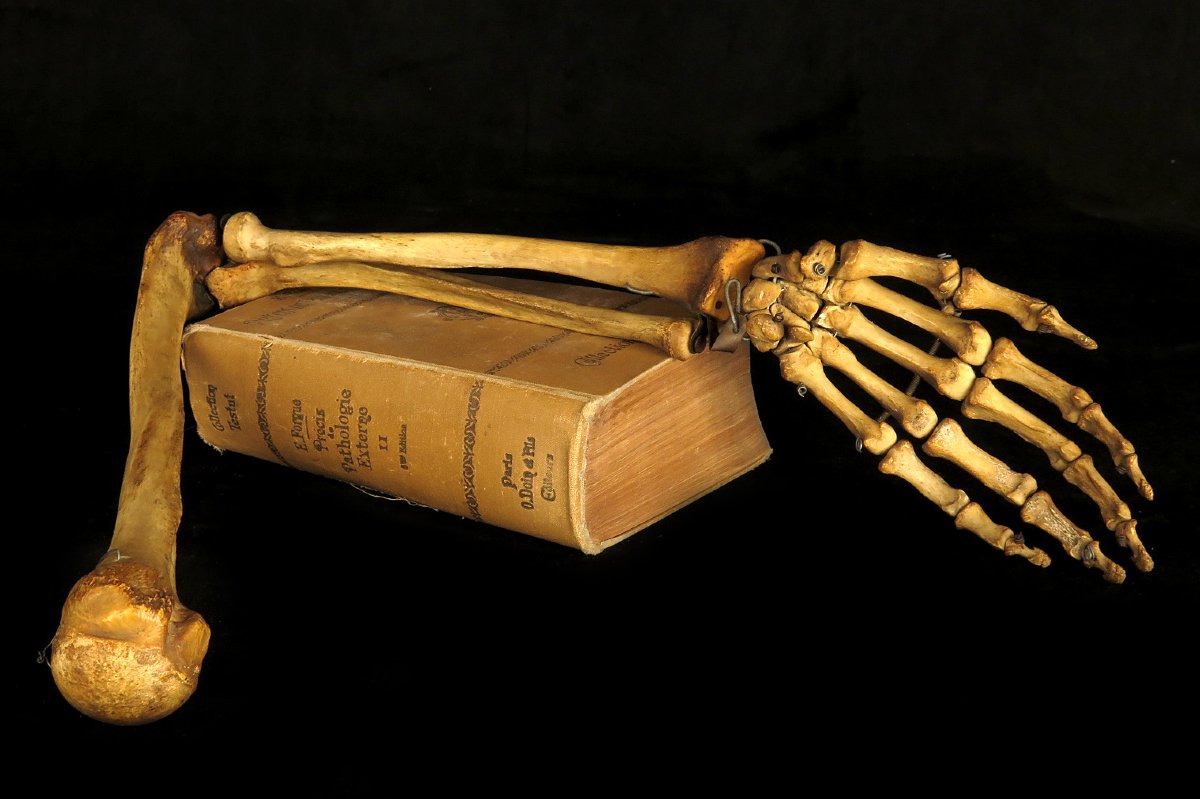 Old Anatomical Skeleton Arm, Late 19th Century Preparation / Oddities-photo-4