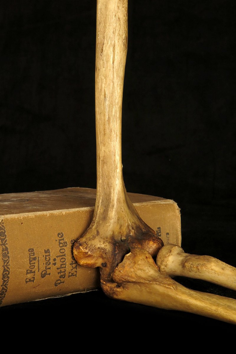 Old Anatomical Skeleton Arm, Late 19th Century Preparation / Oddities-photo-6