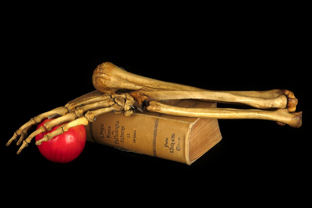 Old Anatomical Skeleton Arm, Late 19th Century Preparation / Oddities-photo-7