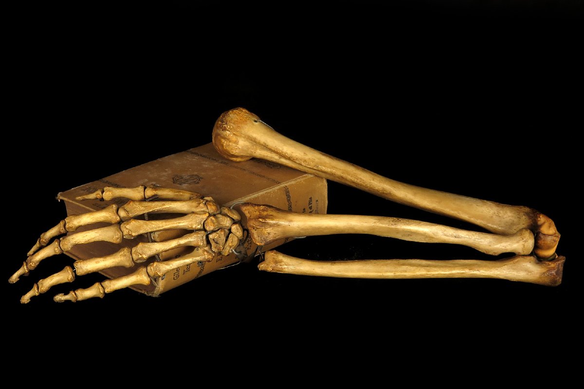 Old Anatomical Skeleton Arm, Late 19th Century Preparation / Oddities