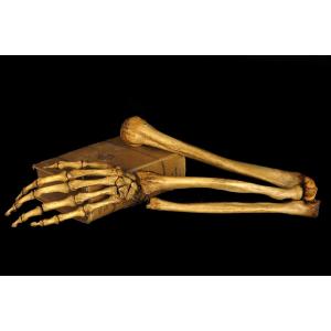 Old Anatomical Skeleton Arm, Late 19th Century Preparation / Oddities