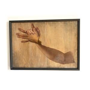Anatomical Study Of Interlaced Hands