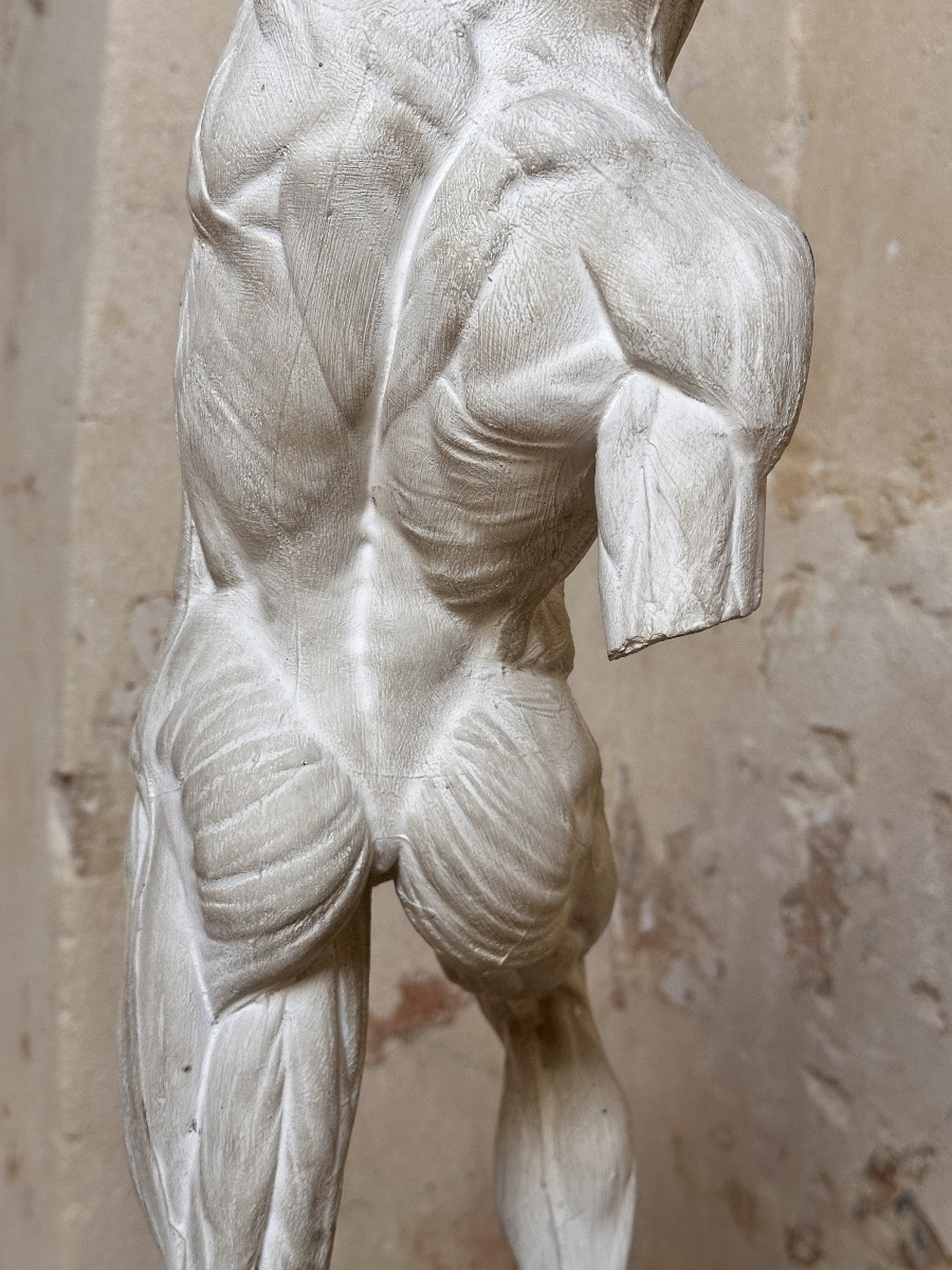 Flayed Fighter - After Jacques-eugène Caudron - Plaster-photo-6