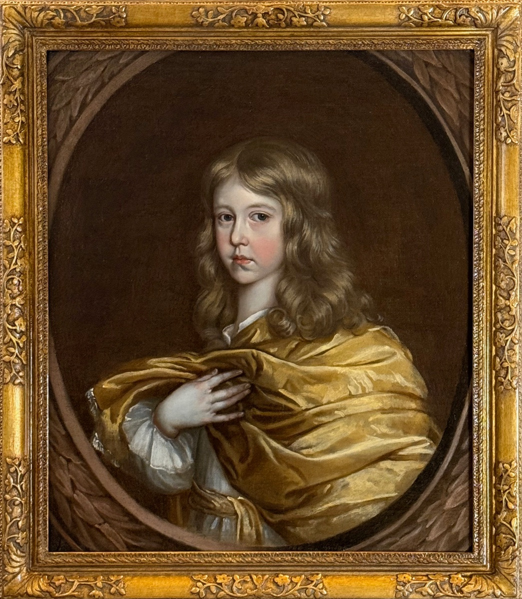 17th Century English School - A Boy With Yellow Dressings-photo-2