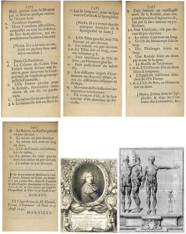 XVIIe s, gde & rare gravure anatomie Crisostomo MARTINEZ, cadre pierres dures-photo-7