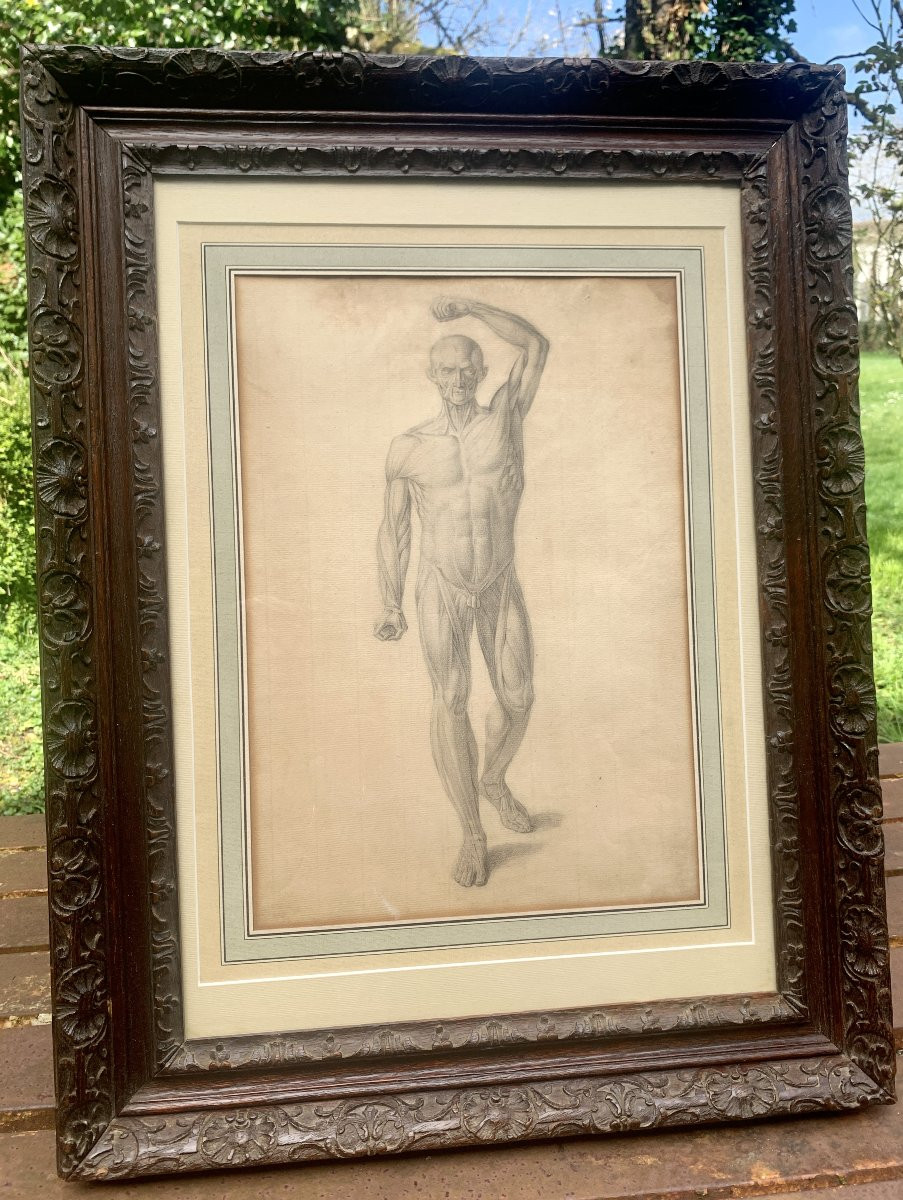 18th Cty, Cabinet Of Curiosities/medicine Drawing In Graphite Flayed Man-photo-4