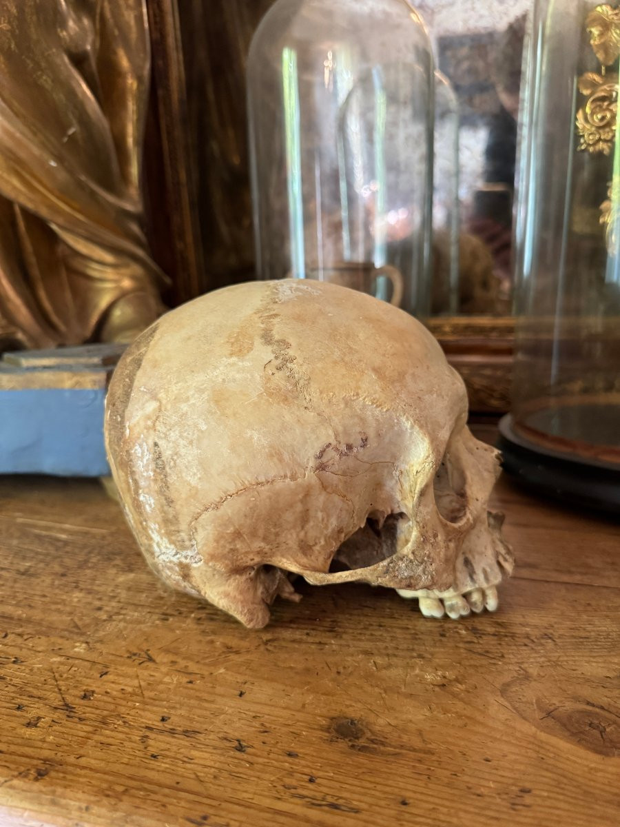 Cr&acirc;ne humain anatomique &ndash; Cabinet de curiosit&eacute;s &ndash; &Eacute;tude m&eacute;dicale &ndash; Vanit&eacute;, Memento Mori-photo-1