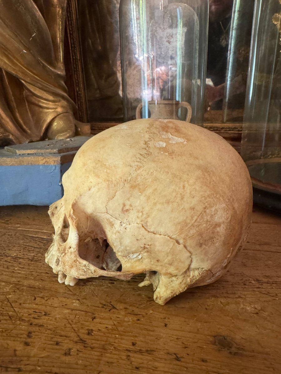 Cr&acirc;ne humain anatomique &ndash; Cabinet de curiosit&eacute;s &ndash; &Eacute;tude m&eacute;dicale &ndash; Vanit&eacute;, Memento Mori-photo-3