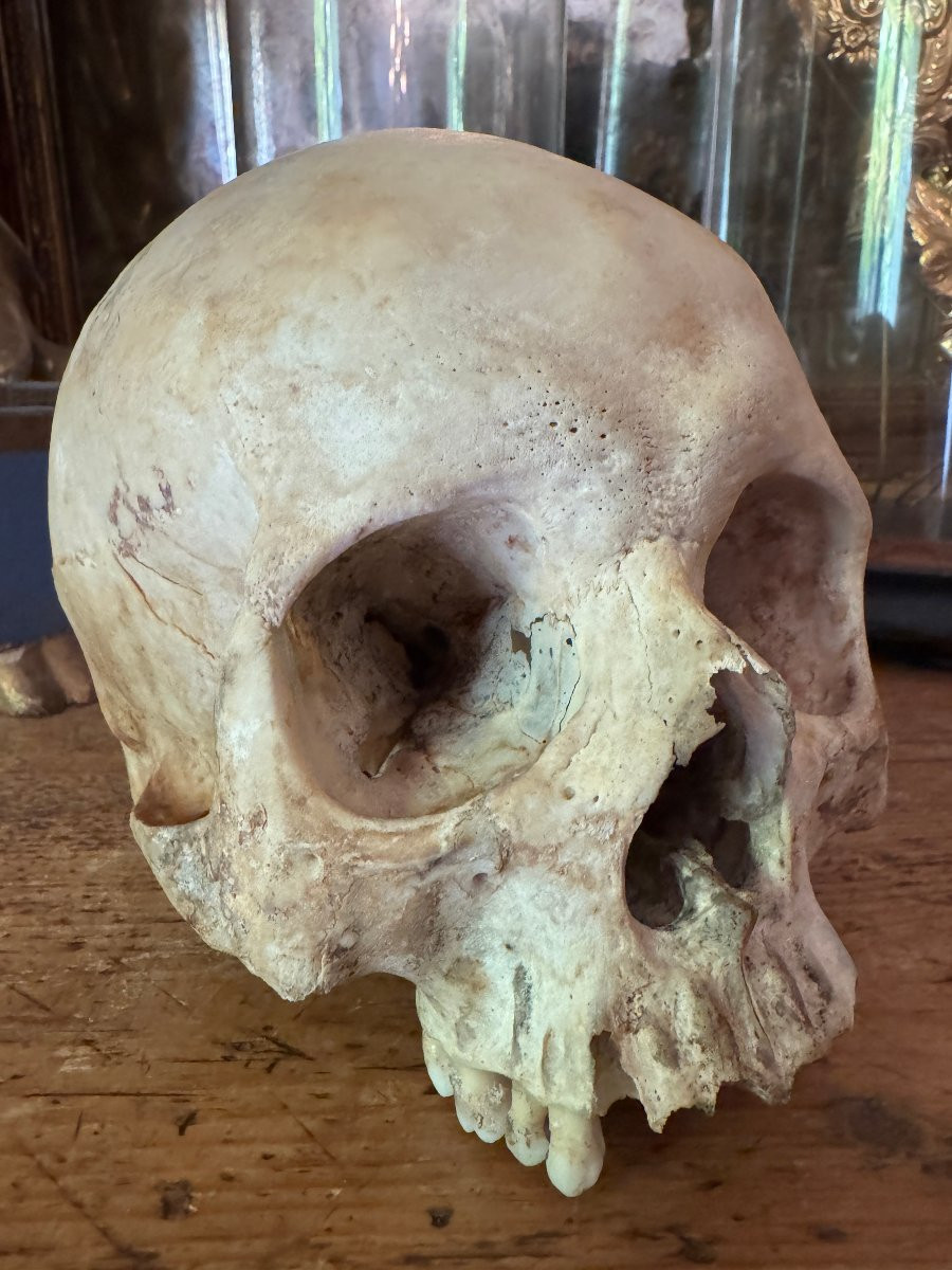 Cr&acirc;ne humain anatomique &ndash; Cabinet de curiosit&eacute;s &ndash; &Eacute;tude m&eacute;dicale &ndash; Vanit&eacute;, Memento Mori-photo-4