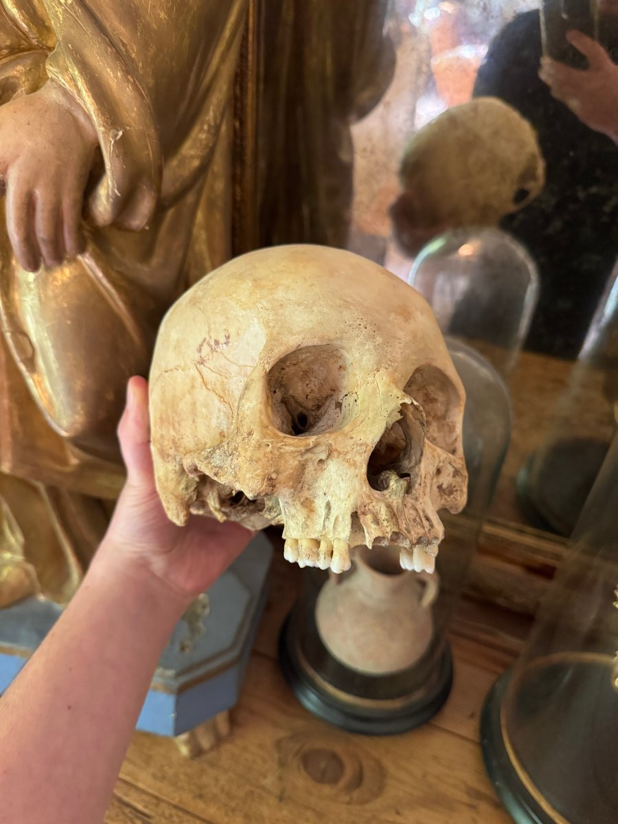 Cr&acirc;ne humain anatomique &ndash; Cabinet de curiosit&eacute;s &ndash; &Eacute;tude m&eacute;dicale &ndash; Vanit&eacute;, Memento Mori-photo-5