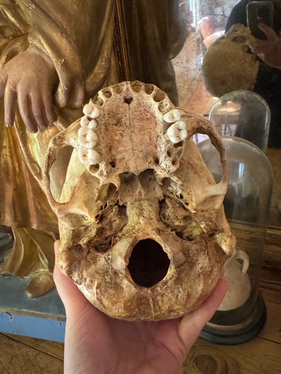 Cr&acirc;ne humain anatomique &ndash; Cabinet de curiosit&eacute;s &ndash; &Eacute;tude m&eacute;dicale &ndash; Vanit&eacute;, Memento Mori-photo-6