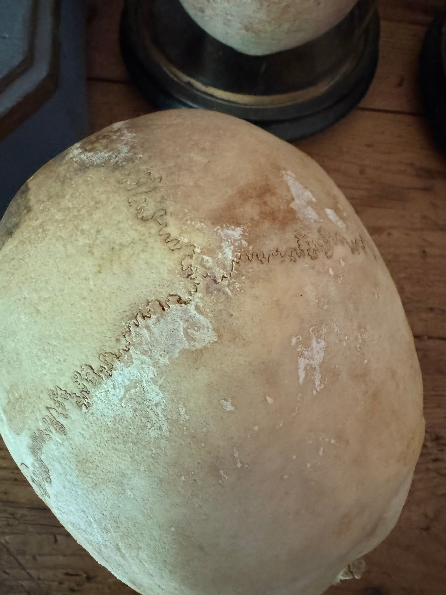 Cr&acirc;ne humain anatomique &ndash; Cabinet de curiosit&eacute;s &ndash; &Eacute;tude m&eacute;dicale &ndash; Vanit&eacute;, Memento Mori-photo-7