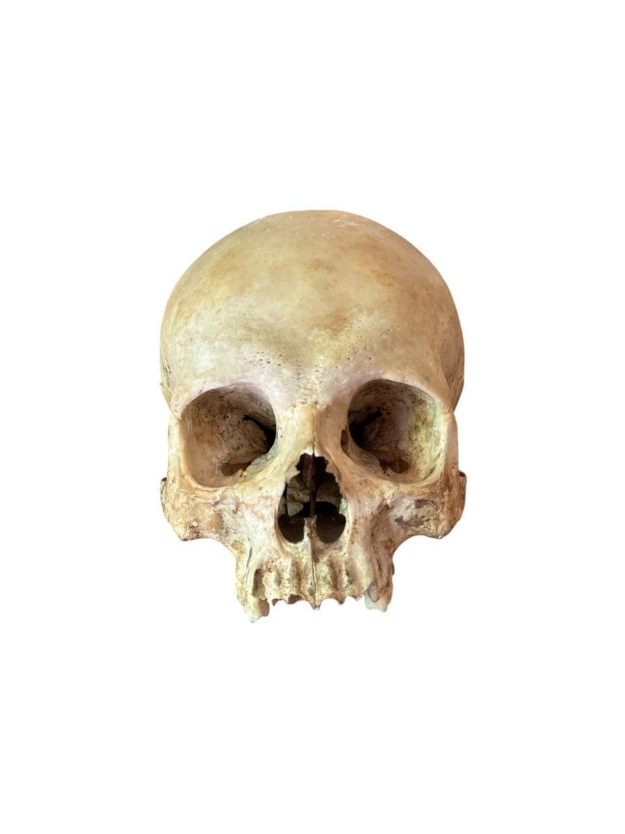 Cr&acirc;ne humain anatomique &ndash; Cabinet de curiosit&eacute;s &ndash; &Eacute;tude m&eacute;dicale &ndash; Vanit&eacute;, Memento Mori