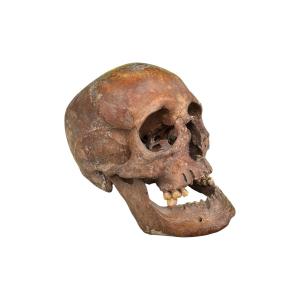 Crâne humain anatomique ancien – Crâne d’étude – Médecine – Anatomie – Collection médicale