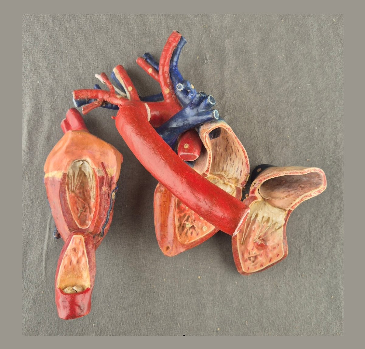 Dr Louis Auzoux - Human Heart.  Removable Anatomical Model (clastic Anatomy) Perfect Condition-photo-4