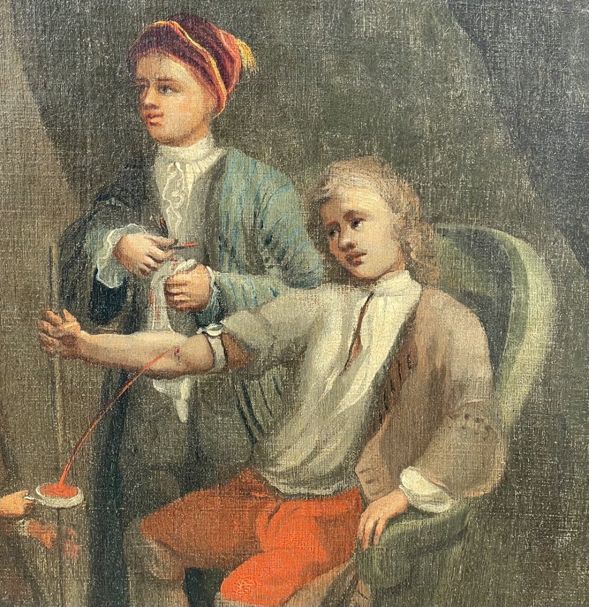 European Painter (18th Century) - The Bloodletting.-photo-3