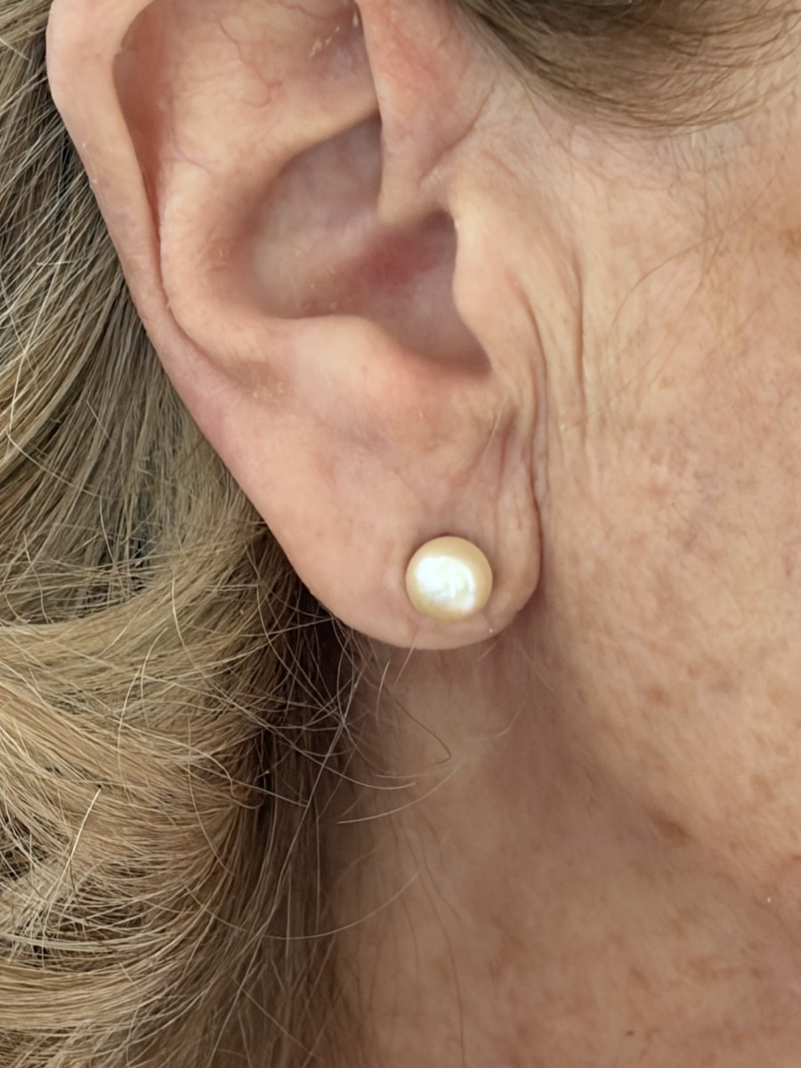 8067 - Vintage Yellow Gold Akoya Pearl Earrings-photo-4